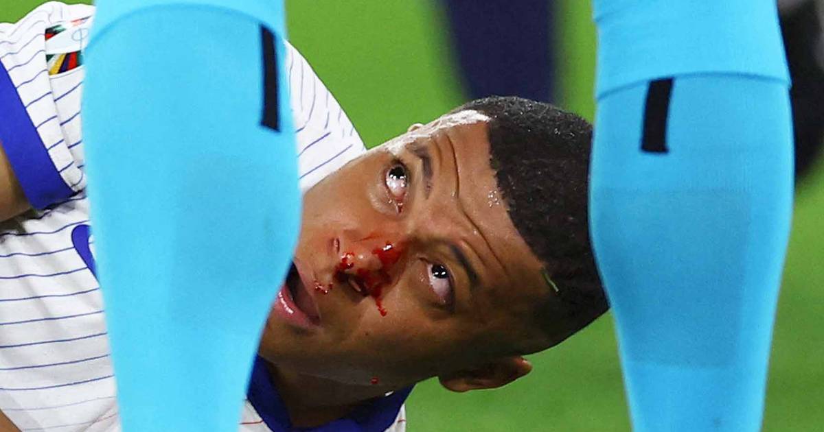 Mbappe zakrwawiony, gdy Francja ledwo pokonuje Austrię samobójczą bramką na Euro 2024 (wideo) – Fox Sports