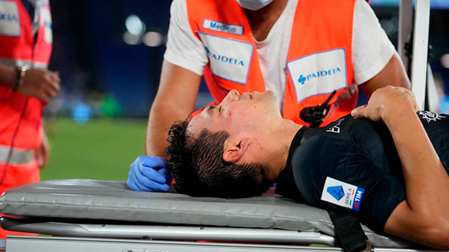 Hirving Lozano sufrió un fuerte golpe en la cara, aunque no resultó en fractura