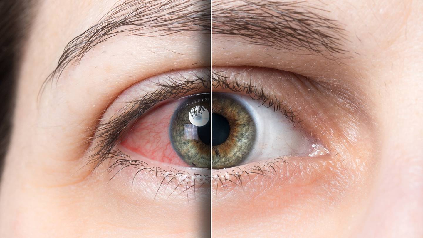 12 Síntomas del mal de ojo - Descubre cómo saber si lo tienes