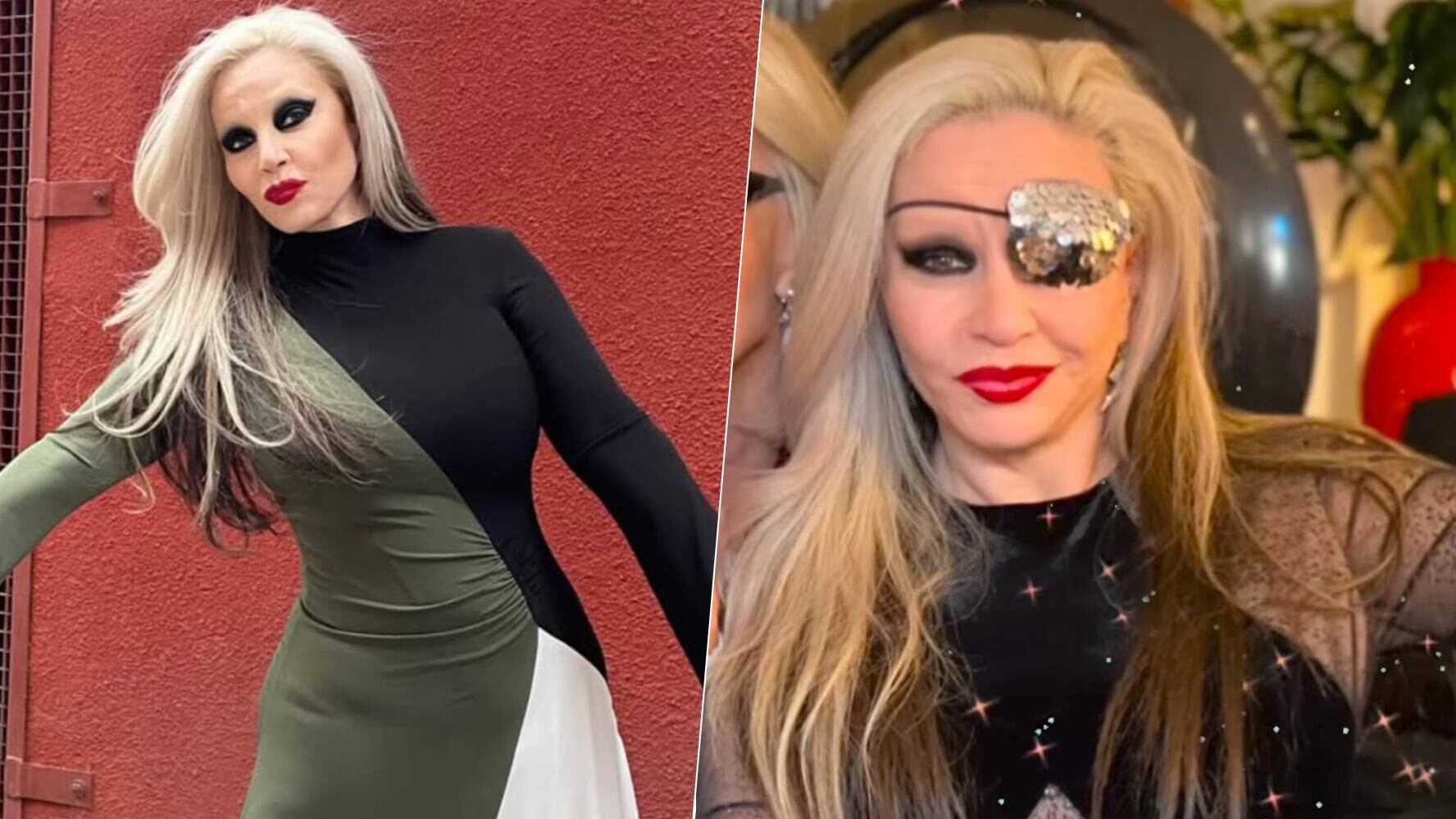 Alaska apareció con un parche en el ojo. (Foto: Instagram @alaskaoficial)